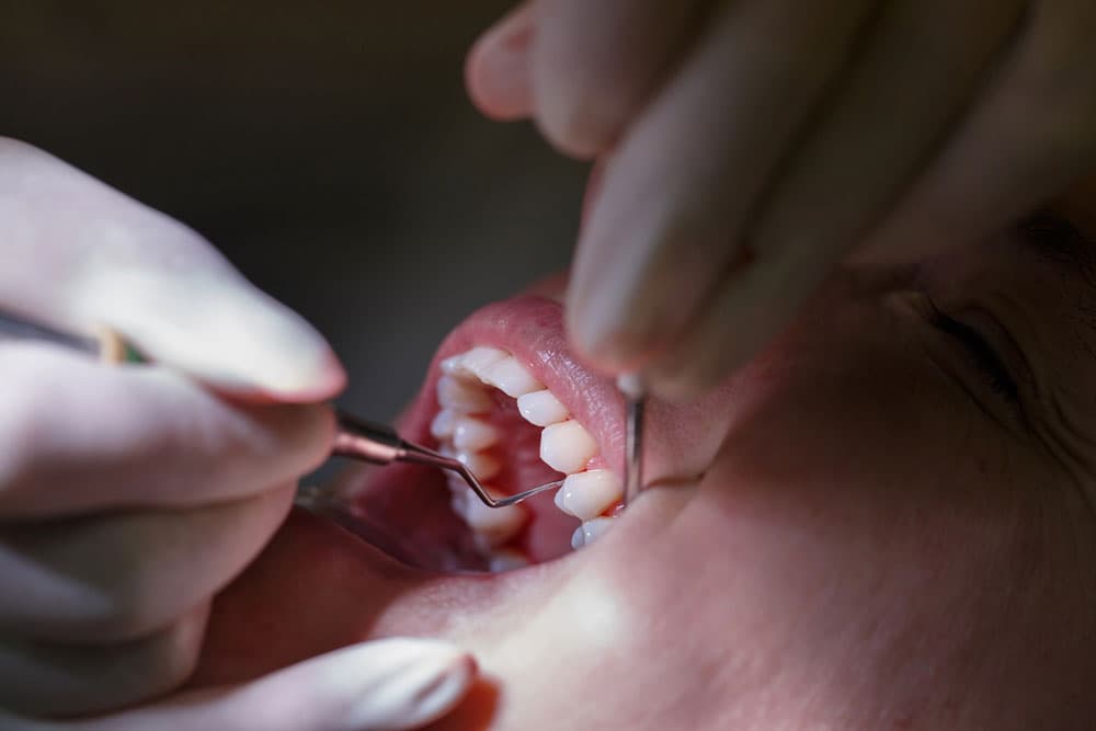 Gum Disease Treatment St Ives